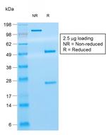 CD8A (Cytotoxic- and Suppressor T-Cell Marker) Antibody in SDS-PAGE (SDS-PAGE)