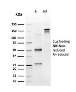 RPS6KA5/MSK1 Antibody in SDS-PAGE (SDS-PAGE)