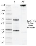 CD22/BL-CAM (B-Cell Marker) Antibody in SDS-PAGE (SDS-PAGE)