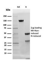 Adiponectin (Marker of Obesity) Antibody in SDS-PAGE (SDS-PAGE)