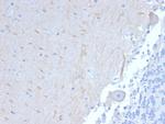 ATG5 Antibody in Immunohistochemistry (Paraffin) (IHC (P))