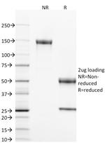 CD40/TNFRSF5/CD40L-Receptor Antibody in SDS-PAGE (SDS-PAGE)