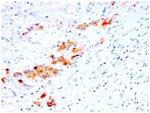 CD44v4 (Marker of Tumor Metastasis) Antibody in Immunohistochemistry (Paraffin) (IHC (P))