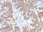 TNFS15/VEGI (Vascular Endothelial Growth Inhibitor) Antibody in Immunohistochemistry (Paraffin) (IHC (P))