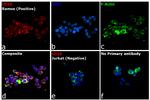 Rat IgG (H+L) Cross-Adsorbed Secondary Antibody in Immunocytochemistry (ICC/IF)