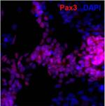 Rabbit IgG (H+L) Highly Cross-Adsorbed Secondary Antibody in Immunocytochemistry (ICC/IF)