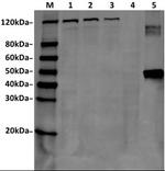 SaCas9 Antibody in Western Blot (WB)