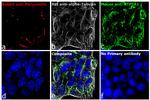 Mouse IgG (H+L) Cross-Adsorbed Secondary Antibody in Immunocytochemistry (ICC/IF)