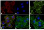 Rat IgG (H+L) Cross-Adsorbed Secondary Antibody in Immunocytochemistry (ICC/IF)