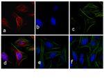 Rabbit IgG (H+L) Cross-Adsorbed Secondary Antibody in Immunocytochemistry (ICC/IF)