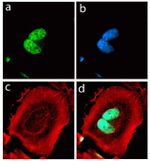 Rabbit IgG (H+L) Highly Cross-Adsorbed Secondary Antibody in Immunocytochemistry (ICC/IF)