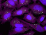 Rabbit IgG (H+L) Highly Cross-Adsorbed Secondary Antibody in Immunocytochemistry (ICC/IF)