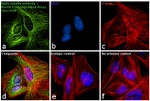 Mouse IgG (H+L) Cross-Adsorbed Secondary Antibody in Immunocytochemistry (ICC/IF)