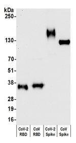 SARS-CoV-2 Spike RBD Antibody in Western Blot (WB)