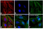 Mouse IgG (H+L) Highly Cross-Adsorbed Secondary Antibody in Immunocytochemistry (ICC/IF)