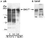 DNMT1 Antibody in Western Blot (WB)