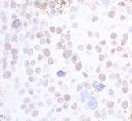 SMC3 Antibody in Immunohistochemistry (Paraffin) (IHC (P))