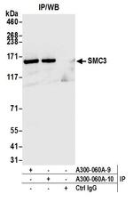 SMC3 Antibody in Immunoprecipitation (IP)