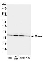 Menin Antibody in Western Blot (WB)