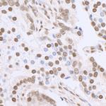 Sp1 Antibody in Immunohistochemistry (Paraffin) (IHC (P))