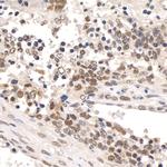 Paf1 Antibody in Immunohistochemistry (Paraffin) (IHC (P))