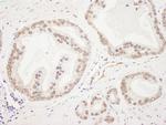 Rad50 Antibody in Immunohistochemistry (Paraffin) (IHC (P))