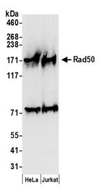 Rad50 Antibody in Western Blot (WB)