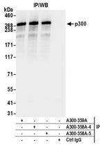 p300 Antibody in Immunoprecipitation (IP)