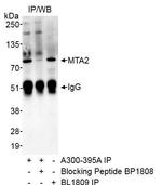 MTA2 Antibody in Immunoprecipitation (IP)