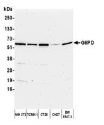 G6PD Antibody in Western Blot (WB)