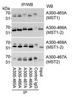 MST1/STK4 Antibody in Immunoprecipitation (IP)