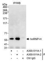 hnRNP-H Antibody in Immunoprecipitation (IP)