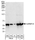 hnRNP-H Antibody in Western Blot (WB)