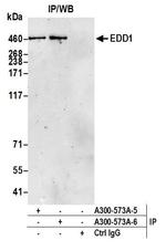 EDD1 Antibody in Immunoprecipitation (IP)