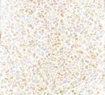 VCP Antibody in Immunohistochemistry (Paraffin) (IHC (P))