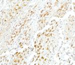 VCP Antibody in Immunohistochemistry (Paraffin) (IHC (P))