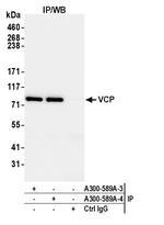 VCP Antibody in Immunoprecipitation (IP)