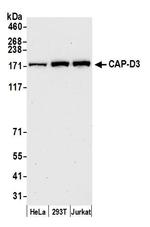 CAP-D3 Antibody in Western Blot (WB)