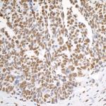 hnRNP-K Antibody in Immunohistochemistry (Paraffin) (IHC (P))