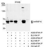 hnRNP-K Antibody in Immunoprecipitation (IP)