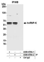 hnRNP-K Antibody in Immunoprecipitation (IP)