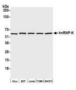 hnRNP-K Antibody in Western Blot (WB)