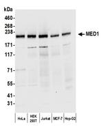 CRSP1/TRAP220 Antibody in Western Blot (WB)