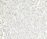 BRG1/SMARCA4 Antibody in Immunohistochemistry (Paraffin) (IHC (P))