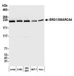 BRG1/SMARCA4 Antibody in Western Blot (WB)