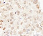 Cul3 Antibody in Immunohistochemistry (Paraffin) (IHC (P))