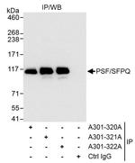 PSF/SFPQ Antibody in Immunoprecipitation (IP)