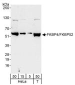 FKBP4/FKBP52 Antibody in Western Blot (WB)