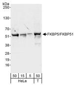 FKBP5/FKBP51 Antibody in Western Blot (WB)