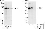 MAP4 Antibody in Western Blot (WB)